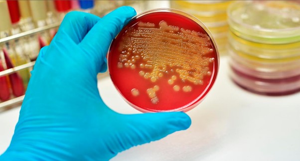 Анализ кала: что может показать?